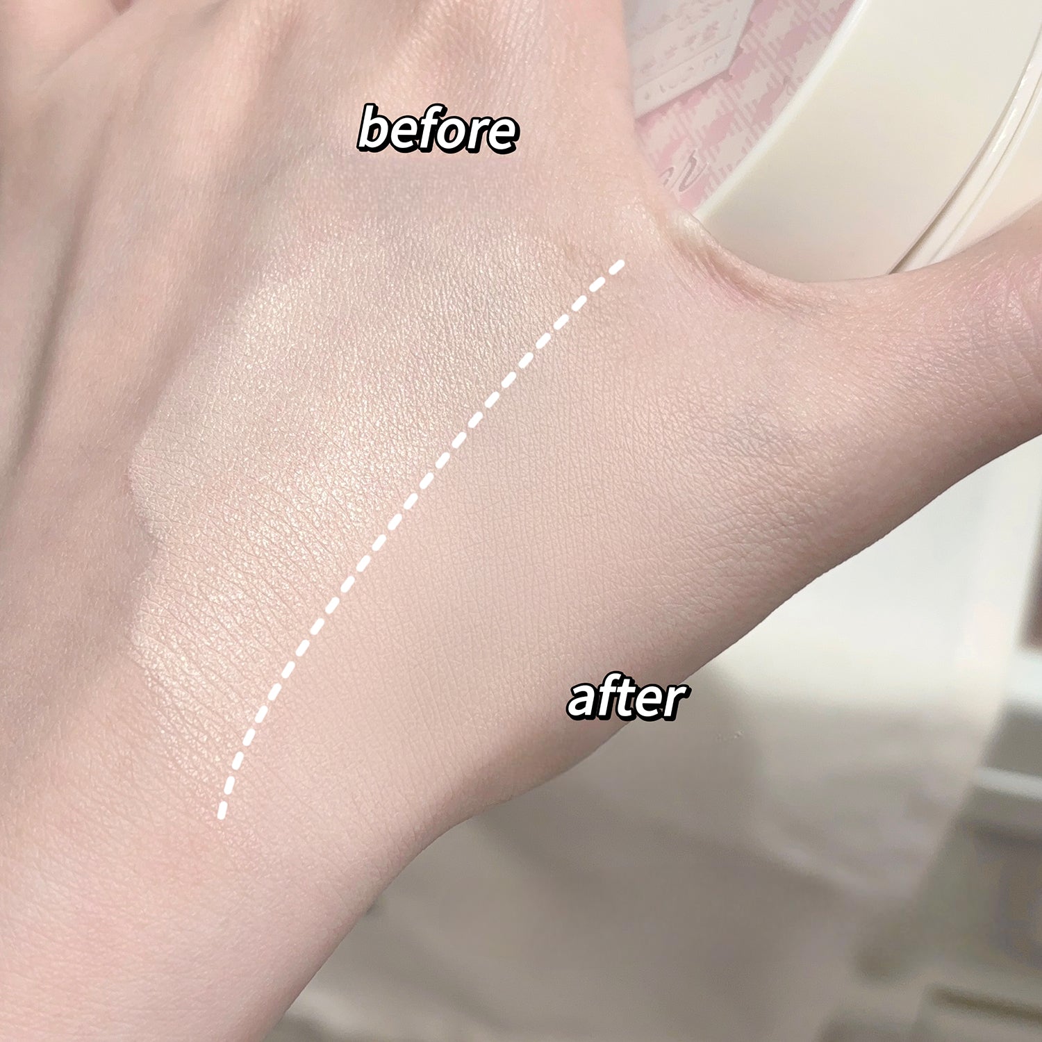 Before and after comparison of a hand with a white line indicating treatment area.